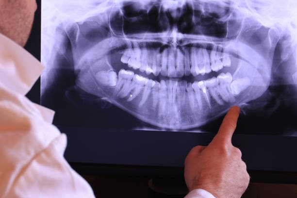 Best Dentist for Tooth Abscess  in Brownwood, TX