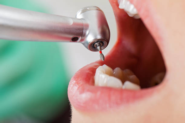 Best Tooth Pain Emergency Relief  in Brownwood, TX